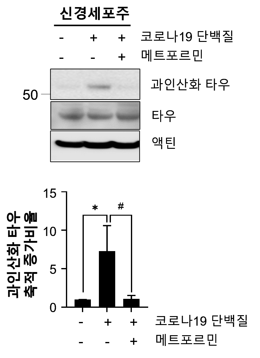 그림입니다. 원본 그림의 이름: 과인산화 타우 축적_v1.png 원본 그림의 크기: 가로 844pixel, 세로 1162pixel