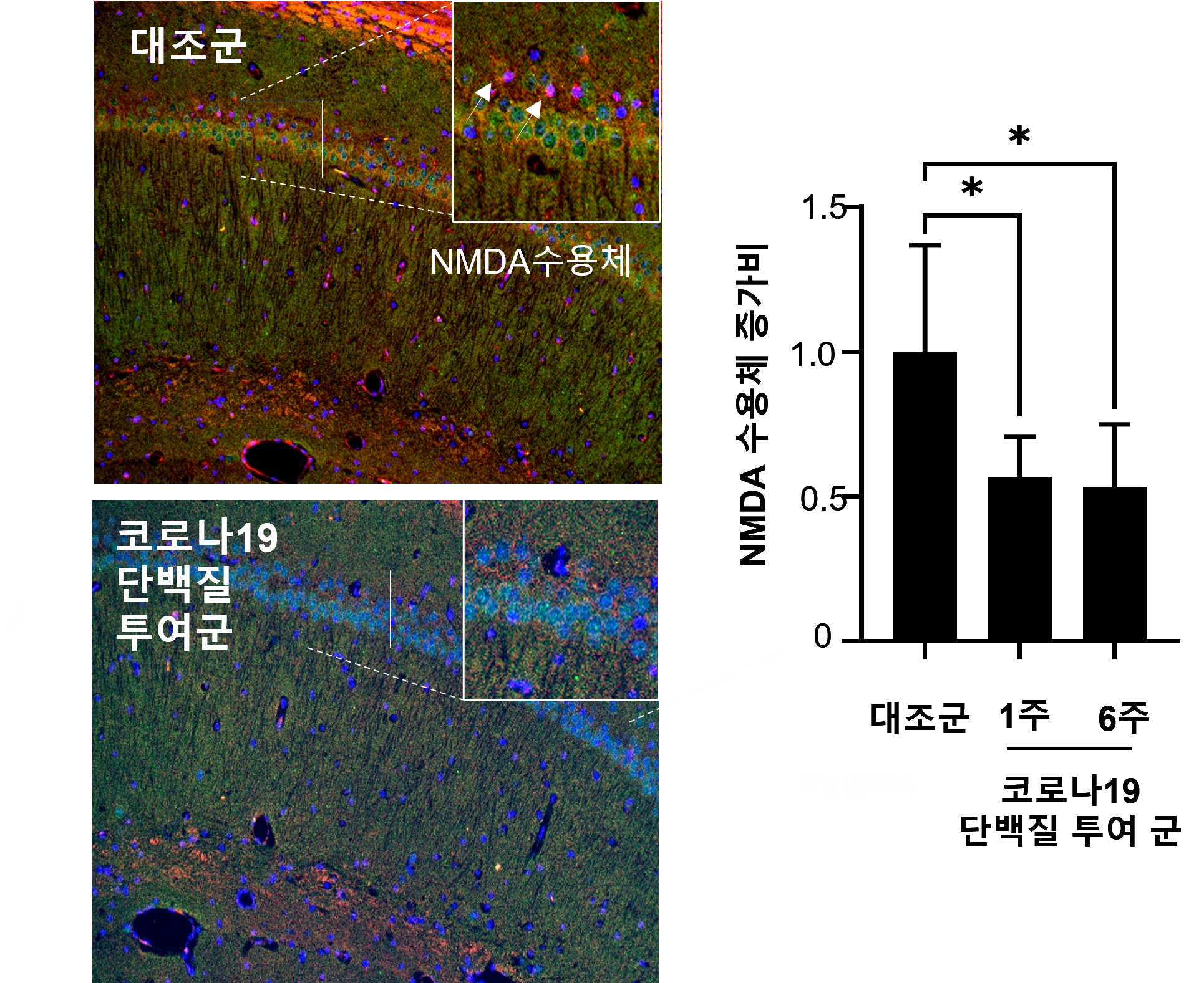 그림입니다. 원본 그림의 이름: NMDA 수용체 감소.png 원본 그림의 크기: 가로 1930pixel, 세로 1577pixel